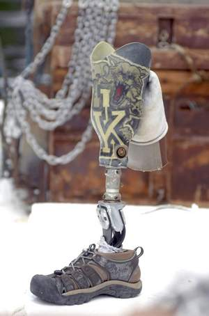 Illustration for article titled Found: One University Of Kentucky Prosthetic Leg